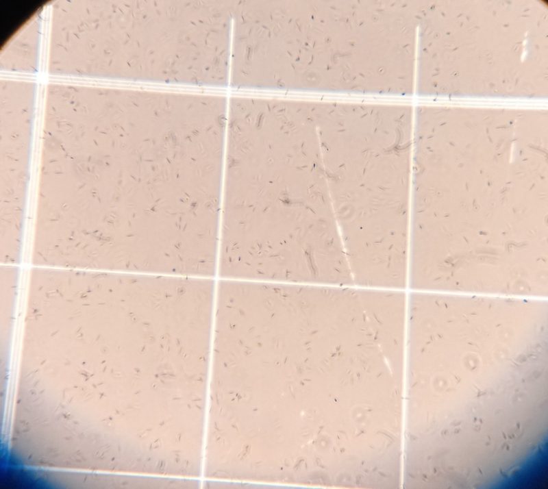 A picture of a sample in a microscope. 