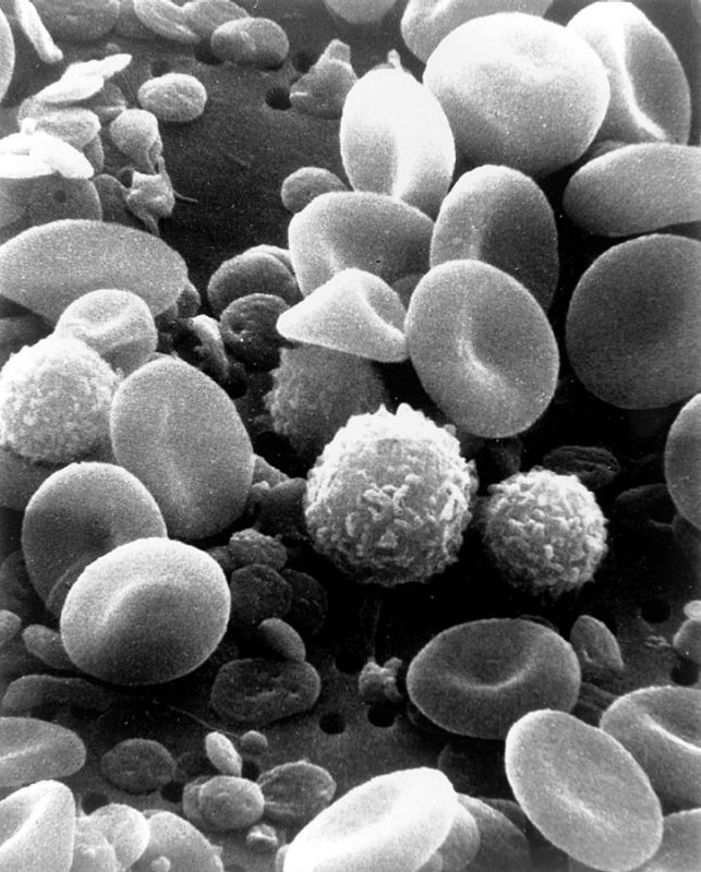 A microscopic image of blood taken from the open access website wikimedia.org 